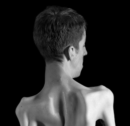 This is a Brian Charles Steel black and white photographic portrait of photographer Brian Charles Steel.  He is positioned in the right side of the frame, and his back is turned to the camera.  He is wearing no shirt and you can see the effect of scoliosis on his back.  The light creates shadows across his back that reveals the uniqueness of his form. He is wearing dark pants and his shown from just above the knees and up. The background is solid black. 